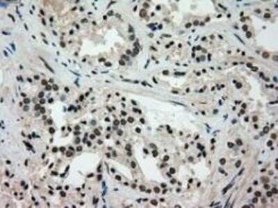 Immunohistochemistry: Glucokinase/GCK Antibody (OTI3E3) - Azide and BSA Free [NBP2-70822]