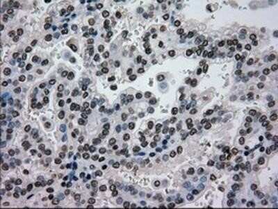 Immunohistochemistry: Glucokinase/GCK Antibody (OTI3E3) - Azide and BSA Free [NBP2-70822]