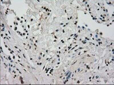 Immunohistochemistry: Glucokinase/GCK Antibody (OTI3E3) - Azide and BSA Free [NBP2-70822]