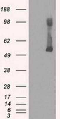 Western Blot: Glucokinase/GCK Antibody (OTI3E3)Azide and BSA Free [NBP2-70822]