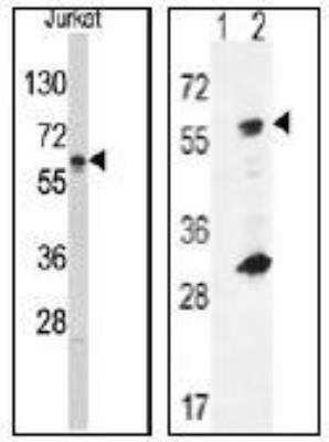 Western Blot: Glucokinase/GCK Antibody [NBP1-50694]