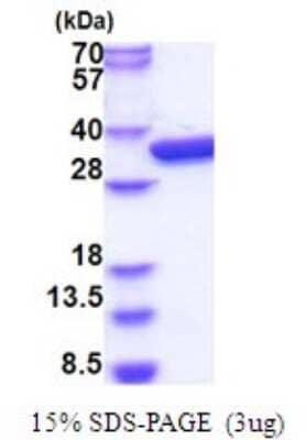 SDS-PAGE: Recombinant E. coli Glucokinase/GCK His Protein [NBP2-51822]