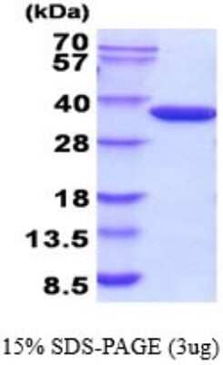 SDS-PAGE: Recombinant E. coli Glucokinase/GCK His Protein [NBP2-52233]