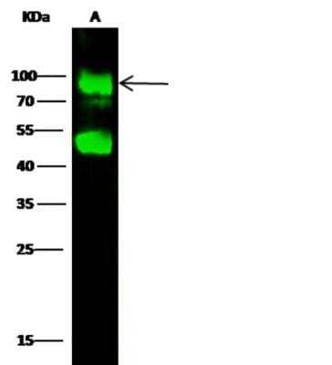 Western Blot: Glucosamine (N-acetyl)-6-Sulfatase/GNS Antibody (007) [NBP2-89413]