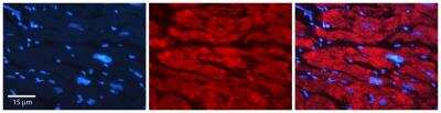 Immunohistochemistry: Glucosamine (N-acetyl)-6-Sulfatase/GNS Antibody [NBP1-69352]