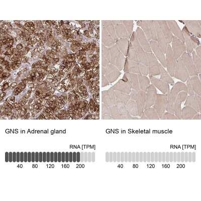 Immunohistochemistry-Paraffin: Glucosamine (N-acetyl)-6-Sulfatase/GNS Antibody [NBP2-38583]