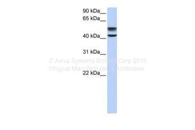 Western Blot: Glucosamine (N-acetyl)-6-Sulfatase/GNS Antibody [NBP1-69352]