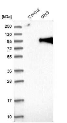 Western Blot: Glucosamine (N-acetyl)-6-Sulfatase/GNS Antibody [NBP1-86084]