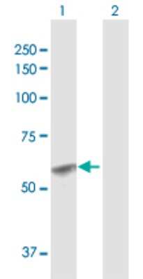 Western Blot: Glucosaminyl (N-acetyl) Transferase 1/GCNT1 Antibody [H00002650-D01P]