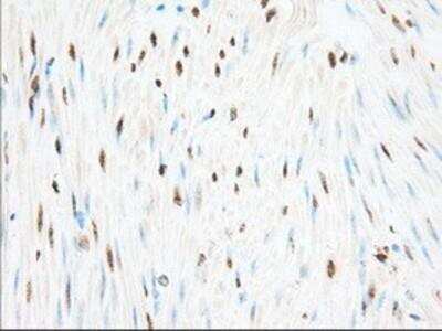Immunohistochemistry-Paraffin: Glucose 1-dehydrogenase Antibody (OTI2A7) [NBP2-02615]