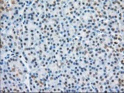 Immunohistochemistry-Paraffin: Glucose 1-dehydrogenase Antibody (OTI2A7) [NBP2-02615]