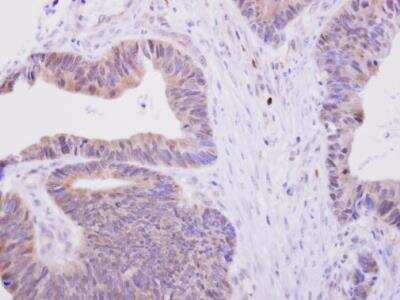 Immunohistochemistry-Paraffin: Glucose 1-dehydrogenase Antibody [NBP1-31588]