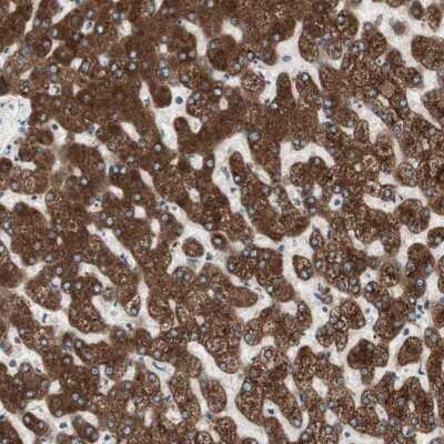 Immunohistochemistry-Paraffin: Glucose 1-dehydrogenase Antibody [NBP1-91942]