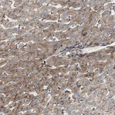 Immunohistochemistry-Paraffin: Glucose 1-dehydrogenase Antibody [NBP1-91943]