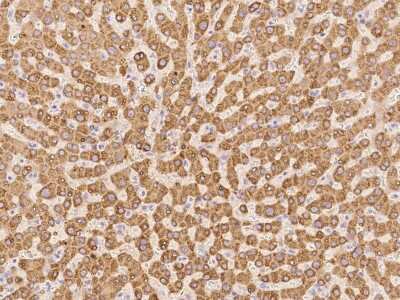 Immunohistochemistry-Paraffin: Glucose 1-dehydrogenase Antibody [NBP2-97731]