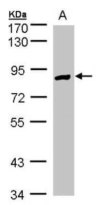 Western Blot: Glucose 1-dehydrogenase Antibody [NBP1-31588]