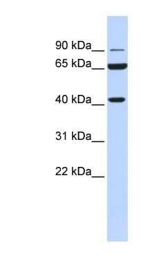 Western Blot: Glucose 1-dehydrogenase Antibody [NBP1-57903]