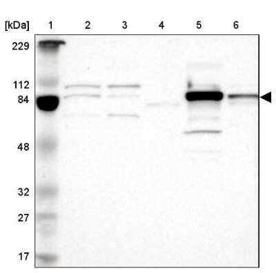 Western Blot: Glucose 1-dehydrogenase Antibody [NBP1-91942]