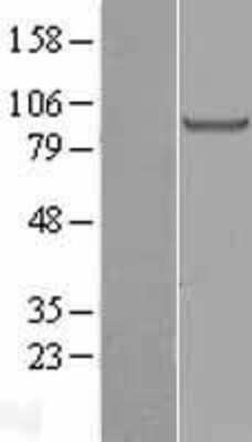 Western Blot: Glucose 1-dehydrogenase Overexpression Lysate [NBL1-11430]