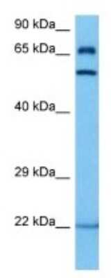 Western Blot: Glucose 6 Phosphate 1-Dehydrogenase 2 Antibody [NBP3-10177]