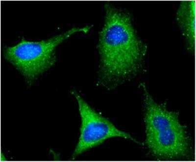 Immunocytochemistry/ Immunofluorescence: Glucose 6 Phosphate Dehydrogenase Antibody (2F6) - BSA Free [NBP1-30358]