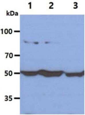 Western Blot: Glucose 6 Phosphate Dehydrogenase Antibody (2F6)BSA Free [NBP1-30358]