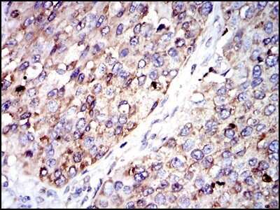 Immunohistochemistry-Paraffin: Glucose 6 Phosphate Dehydrogenase Antibody (2H7) - Azide and BSA Free [NBP2-80752]
