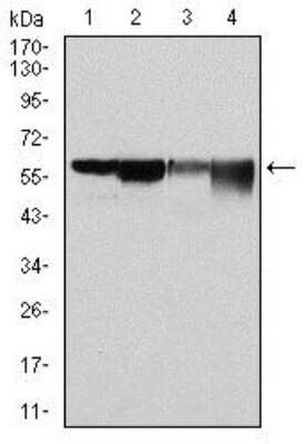 Western Blot: Glucose 6 Phosphate Dehydrogenase Antibody (2H7)Azide and BSA Free [NBP2-80752]