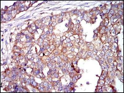 Immunohistochemistry-Paraffin: Glucose 6 Phosphate Dehydrogenase Antibody (2H7) - BSA Free [NBP2-22125]