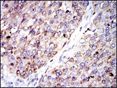 Immunohistochemistry-Paraffin: Glucose 6 Phosphate Dehydrogenase Antibody (2H7) - BSA Free [NBP2-22125]