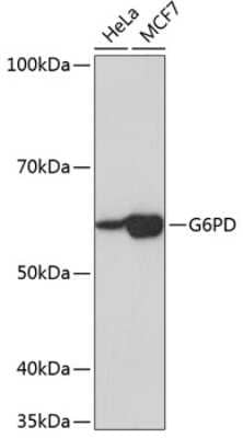 Western Blot: Glucose 6 Phosphate Dehydrogenase Antibody (6V8O9) [NBP3-15359]