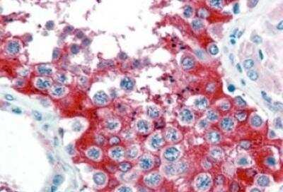 Immunohistochemistry-Paraffin: Glucose 6 Phosphate Dehydrogenase Antibody [NB100-60954]