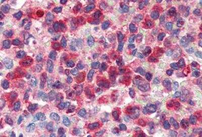 Immunohistochemistry-Paraffin: Glucose 6 Phosphate Dehydrogenase Antibody [NB100-60954]