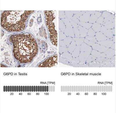 Immunohistochemistry-Paraffin: Glucose 6 Phosphate Dehydrogenase Antibody [NBP1-89804]