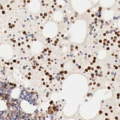 Immunohistochemistry-Paraffin: Glucose 6 Phosphate Dehydrogenase Antibody [NBP1-89805]