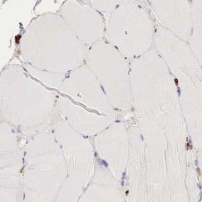 Immunohistochemistry-Paraffin: Glucose 6 Phosphate Dehydrogenase Antibody [NBP1-89805]