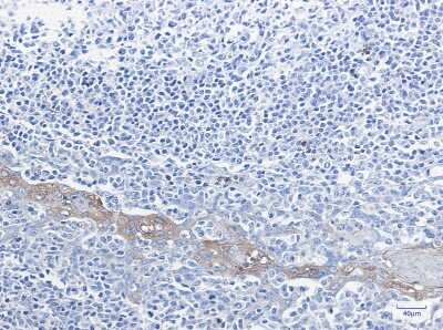 Immunohistochemistry-Paraffin: Glucose 6 Phosphate Dehydrogenase Antibody (S02-6B6) [NBP3-14935]