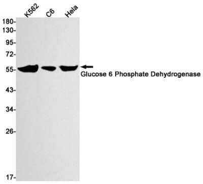 Western Blot: Glucose 6 Phosphate Dehydrogenase Antibody (S02-6B6) [NBP3-14935]