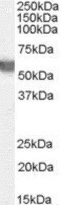 Western Blot: Glucose 6 Phosphate Dehydrogenase Antibody [NB100-60954]