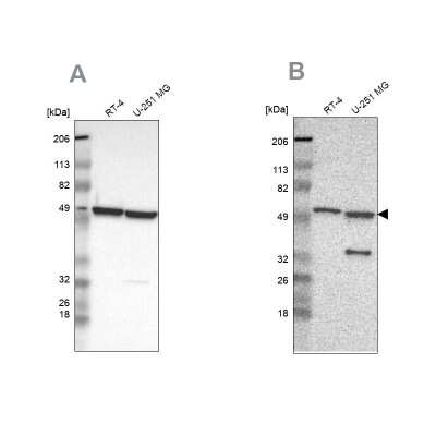 Western Blot: Glucose 6 Phosphate Dehydrogenase Antibody [NBP1-89804]