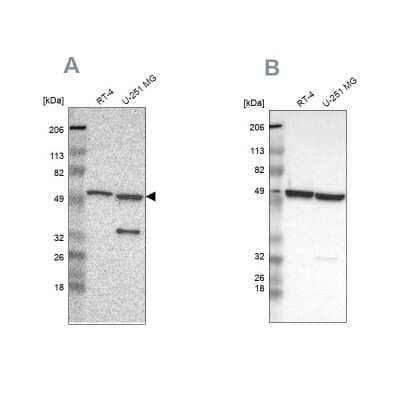 Western Blot: Glucose 6 Phosphate Dehydrogenase Antibody [NBP1-89805]