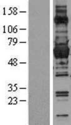 Western Blot: Glucose 6 Phosphate Dehydrogenase Overexpression Lysate [NBL1-10899]