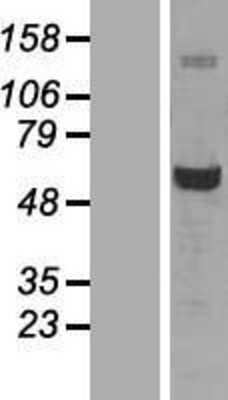 Western Blot: Glucose 6 Phosphate Dehydrogenase Overexpression Lysate [NBL1-10900]