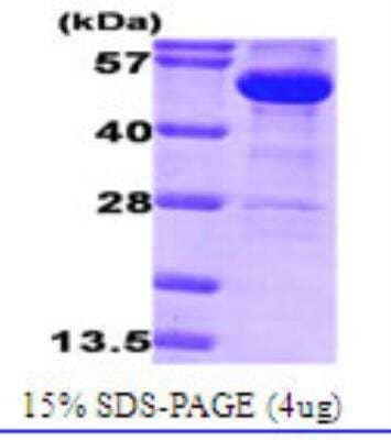 Western Blot: Recombinant E. coli Glucose 6 Phosphate Dehydrogenase Protein [NBC1-19064]