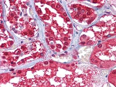 Immunohistochemistry-Paraffin: Glucose 6 phosphate isomerase Antibody (1B7D7) - BSA Free [NBP1-47523]