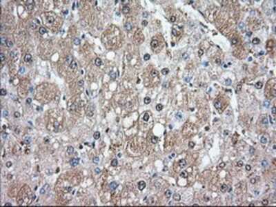 Immunohistochemistry-Paraffin: Glucose 6 phosphate isomerase Antibody (OTI2D2) [NBP2-02541]