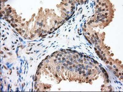 Immunohistochemistry-Paraffin: Glucose 6 phosphate isomerase Antibody (OTI2D2) [NBP2-02541]
