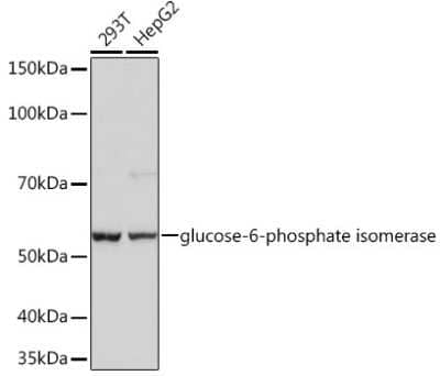 Western Blot: Glucose 6 phosphate isomerase Antibody (2Y8R0) [NBP3-16401]