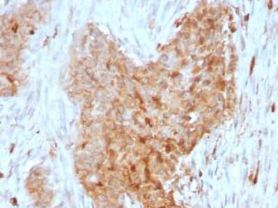 Immunohistochemistry-Paraffin: Glucose 6 phosphate isomerase Antibody (CPTC-GPI-1) [NBP2-79711]