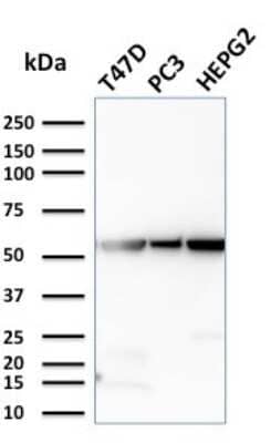 Western Blot: Glucose 6 phosphate isomerase Antibody (CPTC-GPI-1) [NBP2-79711]